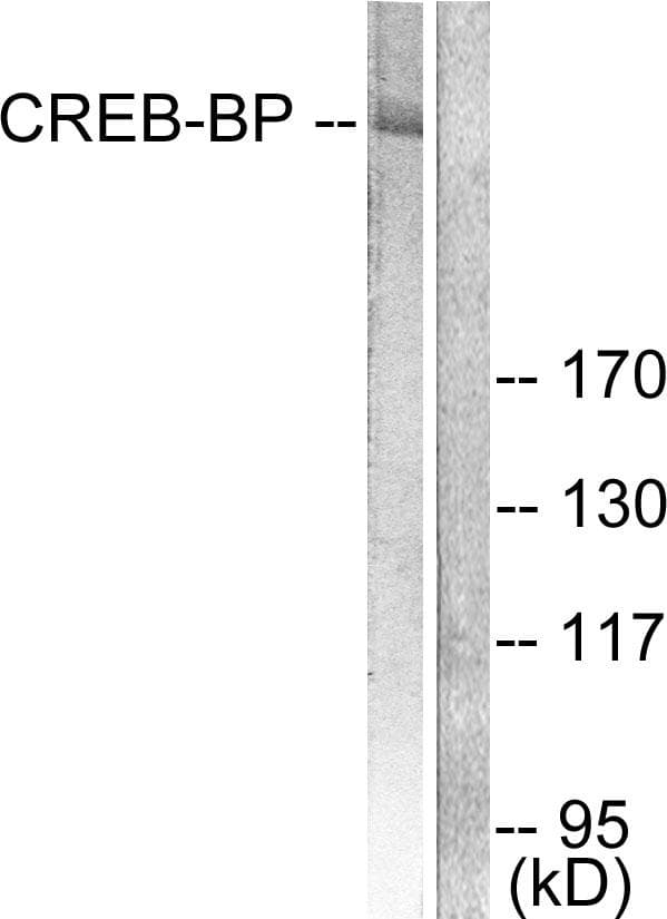 CREBBP / CREB Binding Protein Antibody
