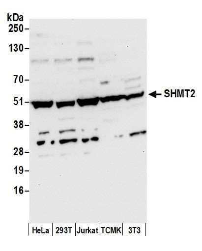 Polyclonal Rabbit anti-Human SHMT / SHMT2 Antibody (aa454-504, WB)