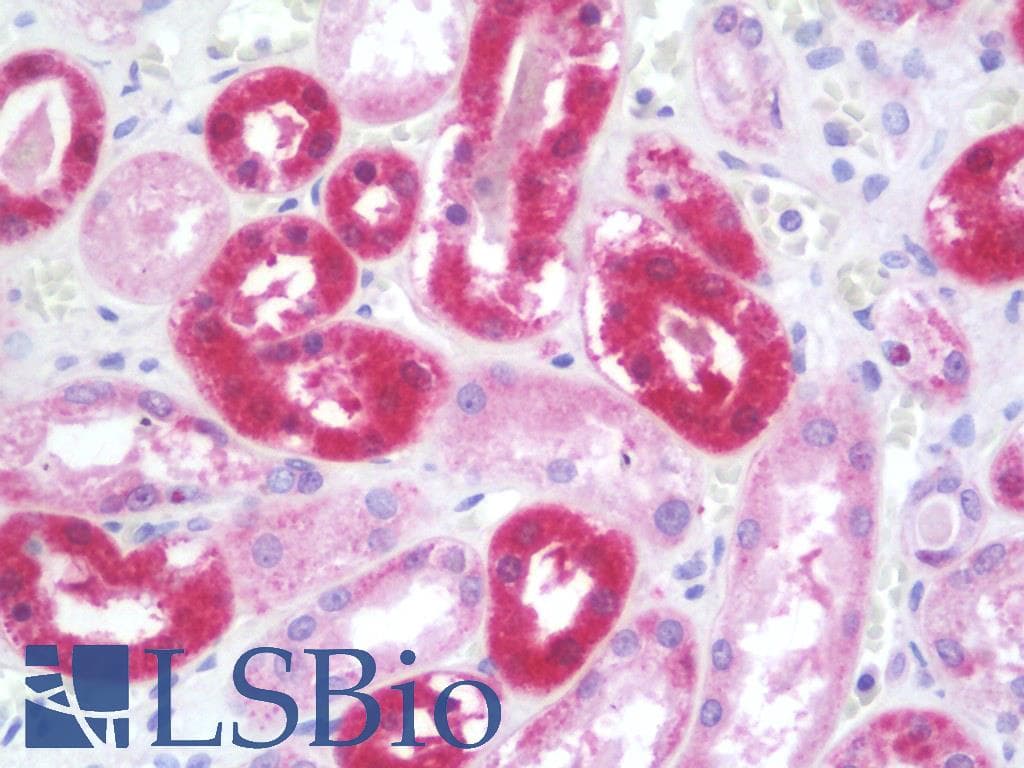 IHC-plus™ INTS2 / INT2 Antibody (aa201-250)