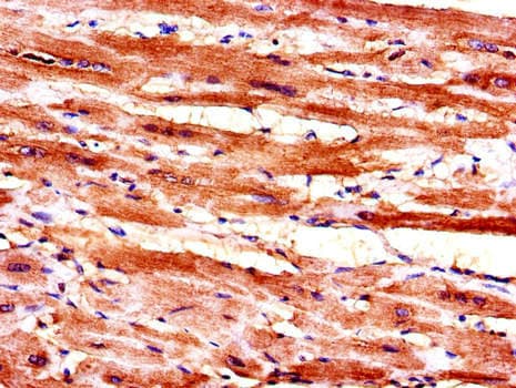 HSPC167 / CDK5RAP1 Antibody