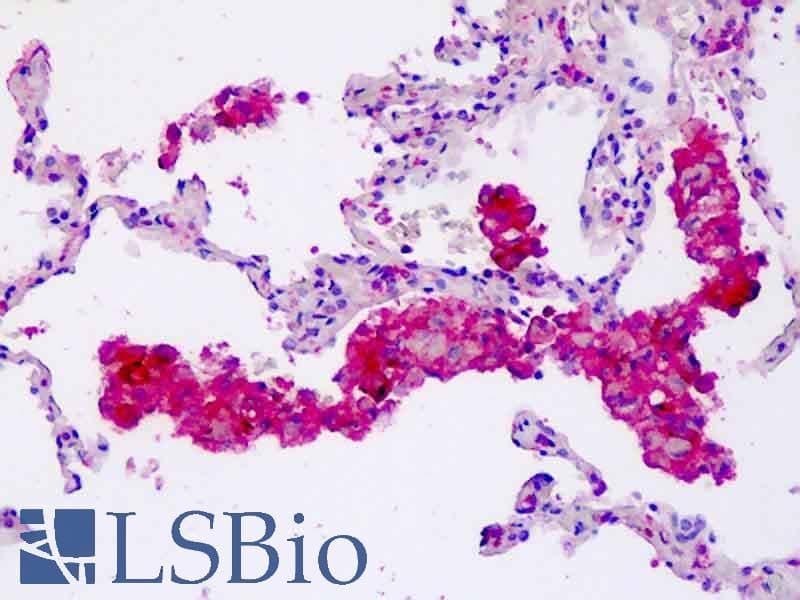 IHC-plus™ Polyclonal Rabbit anti-Human CORO6 Antibody (aa337-365, IHC, WB)