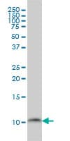 Monoclonal Mouse anti-Human PCBD1 / PHS Antibody (clone 1G11-H5, WB)