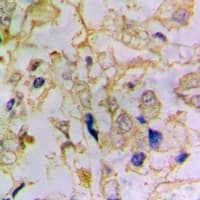 DFFA / ICAD / DFF45 Antibody