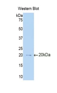 IL3RA / CD123 Antibody (aa17-166)