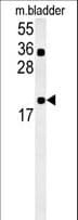 CCDC12 Antibody (aa8-36)