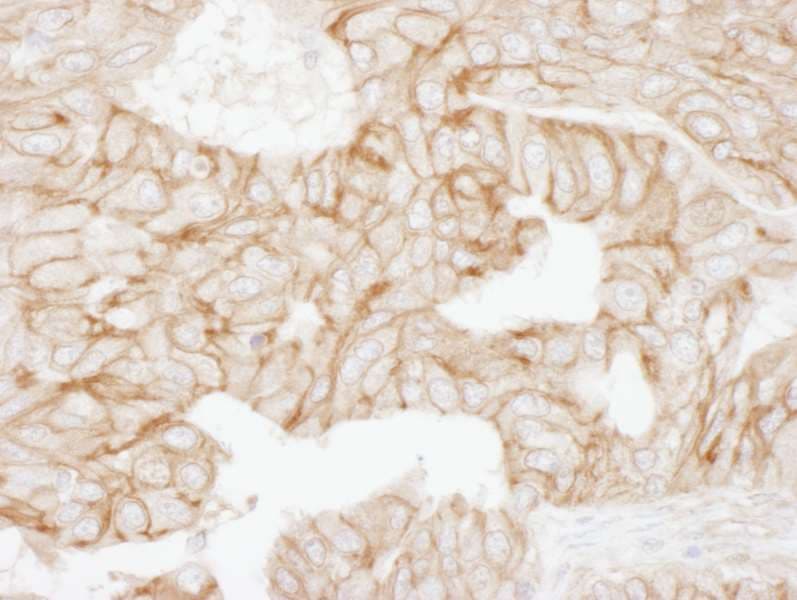 ADD1 / Adducin Alpha Antibody (aa632-682)