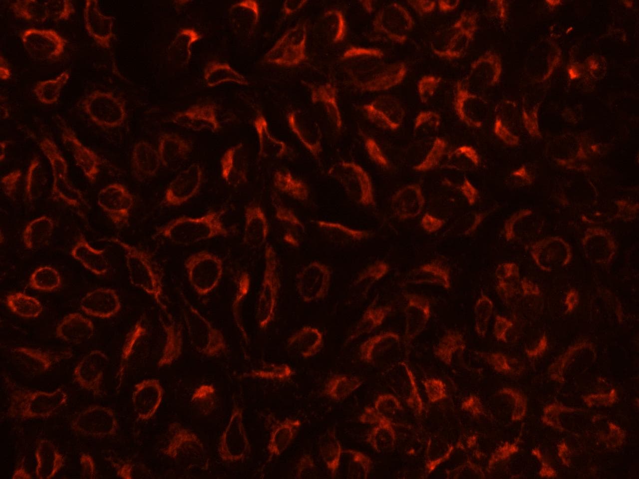 Polyclonal Rabbit anti-Human TBRG4 Antibody (IHC, IF)