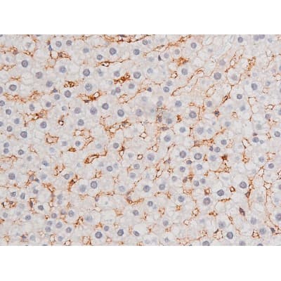 STAT1 Antibody (phospho-Ser727)