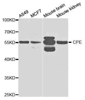 CPE / Carboxypeptidase E Antibody