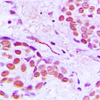 Polyclonal Rabbit anti-Human TUBG1 / Tubulin Gamma 1 Antibody (C-Terminus, IHC, WB)