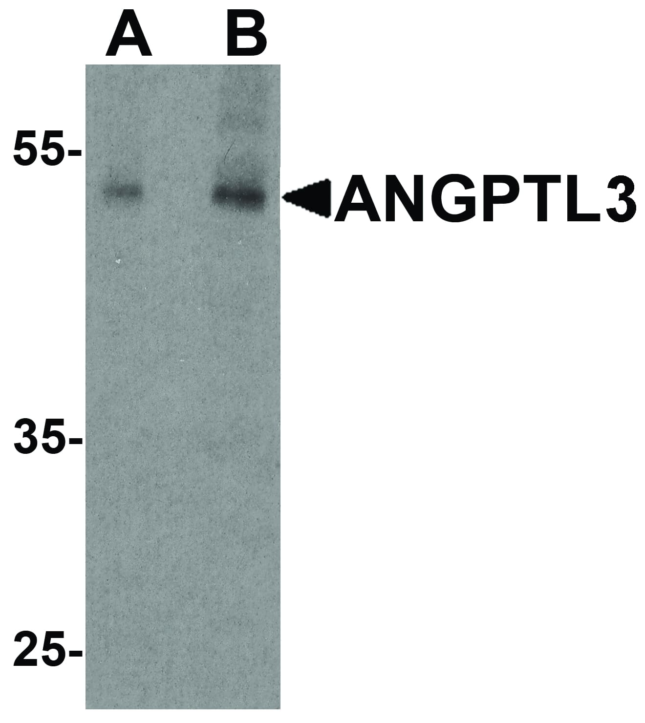 IHC-plus™ ANGPTL3 Antibody