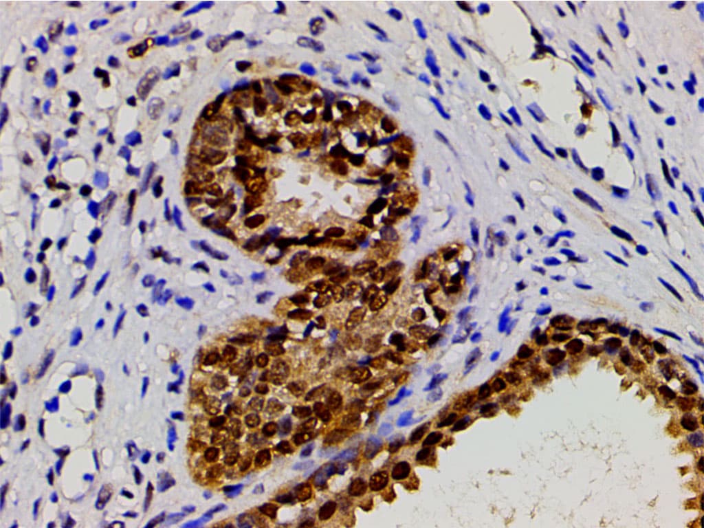 CFL1 / Cofilin Antibody (phospho-Ser3)