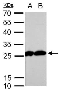 TPI1 / TPI Antibody (aa187-249)