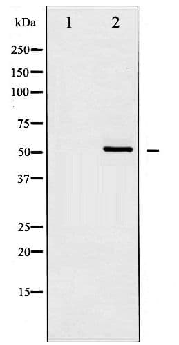 CHEK1 / CHK1 Antibody