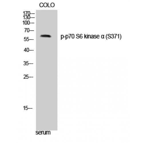 Polyclonal Rabbit anti-Human RPS6KB1 / P70S6K / S6K Antibody (310-390 aa, IHC, WB)