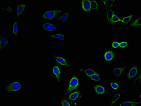 EPHB2 / EPH Receptor B2 Antibody