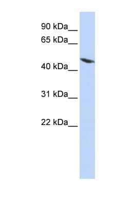 Polyclonal Rabbit anti-Human TEKT4 Antibody (aa72-121, WB)