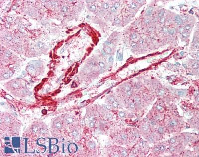 IHC-plus™ CLIP1 / CLIP-170 Antibody (aa1338-1388)