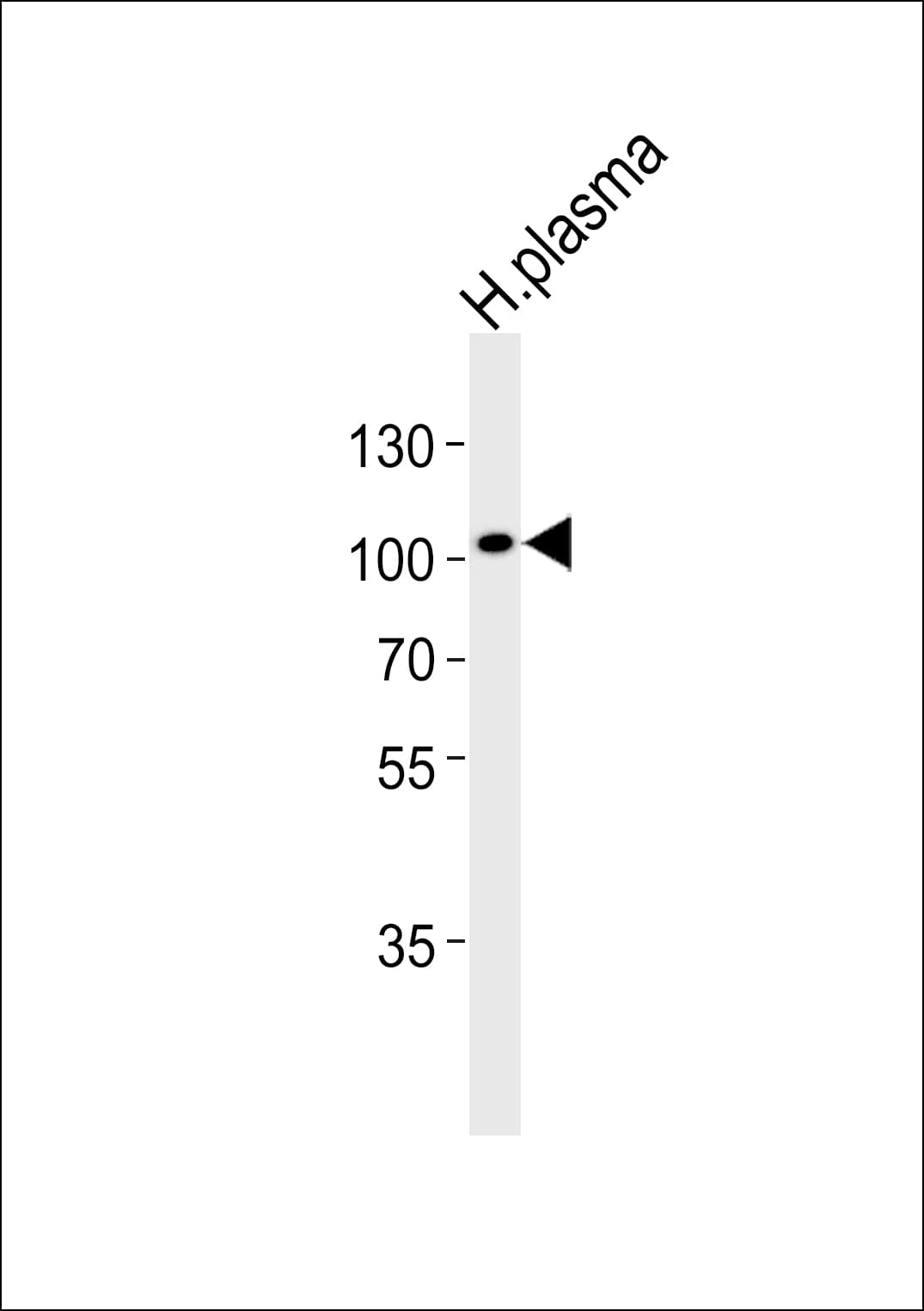 GSN / Gelsolin Antibody (aa36-70)