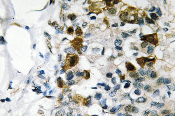 Polyclonal Rabbit anti-Human HSPB1 / HSP27 Antibody (phospho-Ser82, IHC, WB)