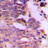 Polyclonal Rabbit anti-Human SIAH1/SIAH2 Antibody (Internal, IHC, IF, WB)