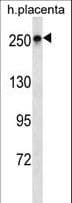 IHC-plus™ SCRIB / Scribble Antibody (aa382-410)