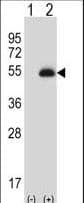 Polyclonal Rabbit anti-Human PAX6 Antibody (IHC, IF, WB)