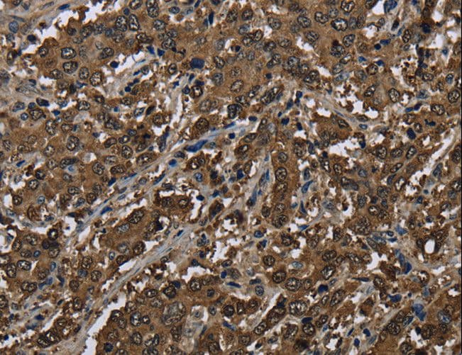 Polyclonal Rabbit anti-Human GSTP1 / GST Pi Antibody (IHC, WB)