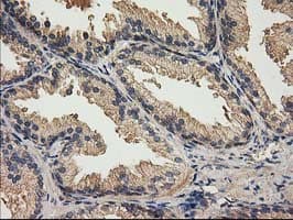 ACOT12 Antibody (clone OTI1B9)