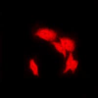 NFKB2 Antibody (C-Terminus)