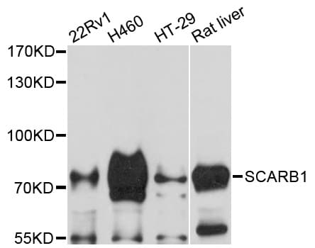 SCARB1 / SR-BI Antibody