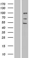 ENDOD1 Protein (Over-Expression Lysate Myc-DDK (Flag))