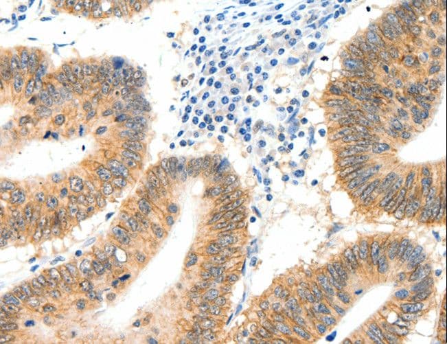 Polyclonal Rabbit anti-Human SIPA1 Antibody (IHC)