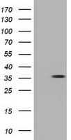 Monoclonal Mouse anti-Human MMS21 / NSMCE2 Antibody (clone OTI4A2, IF, WB)