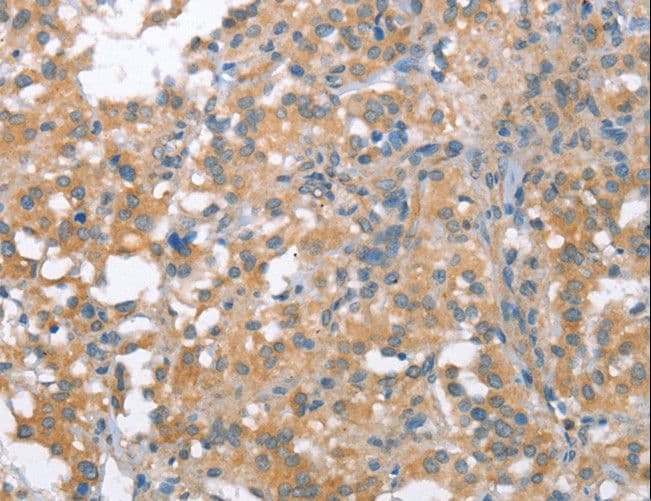 IHC-plus™ NLRP7 / NALP7 Antibody