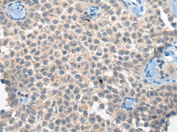 Polyclonal Rabbit anti-Human CLTCL1 / CHC22 Antibody (IHC)