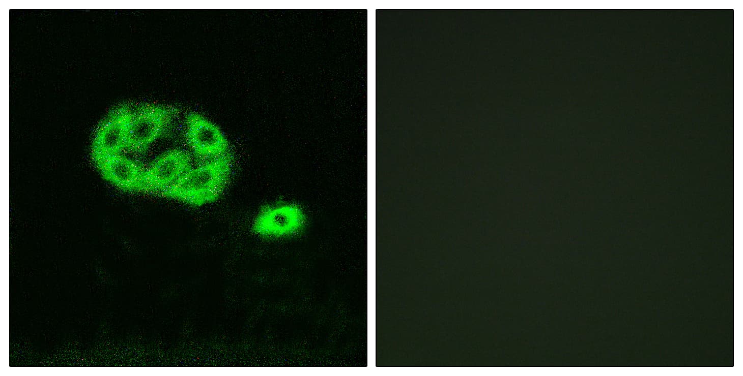 Polyclonal Rabbit anti-Human PI3K Alpha+Gamma Antibody (phospho-Tyr467/Tyr199, IF, WB)