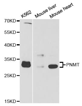 Polyclonal Rabbit anti-Human PNMT Antibody (WB)