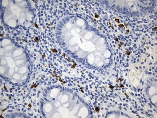 Monoclonal Mouse anti-Human CD275 / B7-H2 / ICOS Ligand Antibody (clone UMAB254, IHC, WB)