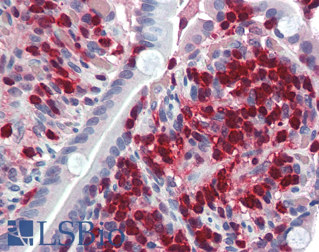 PathPlus™ Polyclonal Goat anti-Human S100A4 / FSP1 Antibody (aa80-C-term, IHC, WB)