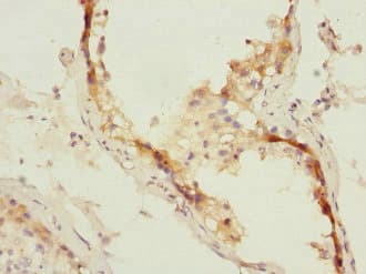 Polyclonal Rabbit anti-Human MID1 Antibody (IHC)