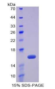 Human FN1 / Fibronectin Protein (Recombinant His)