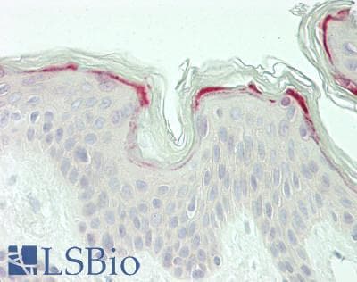 IHC-plus™ LMO7 Antibody (Internal)