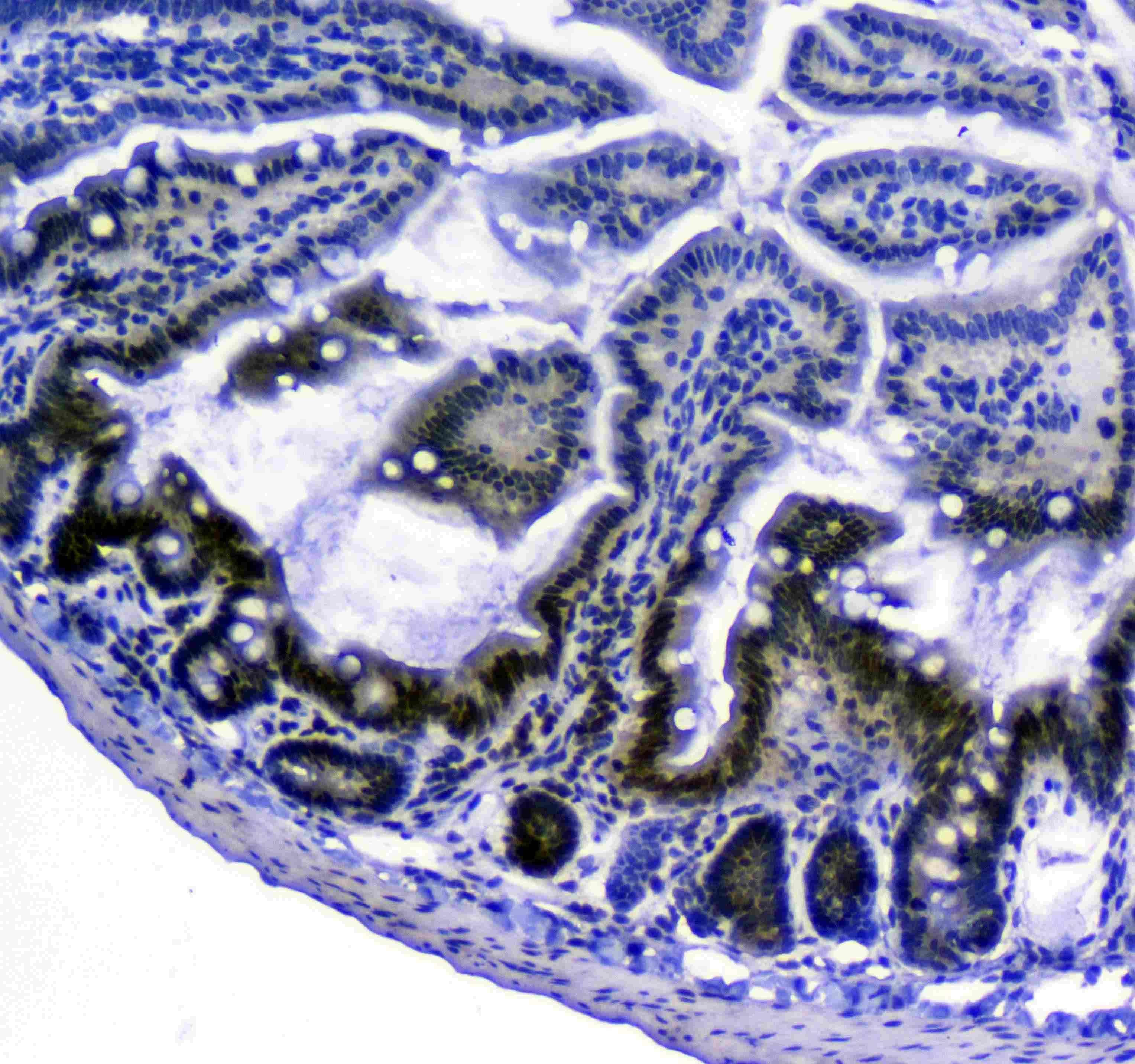 Polyclonal Rabbit anti-Human BCL2 / Bcl-2 Antibody (IHC, WB)