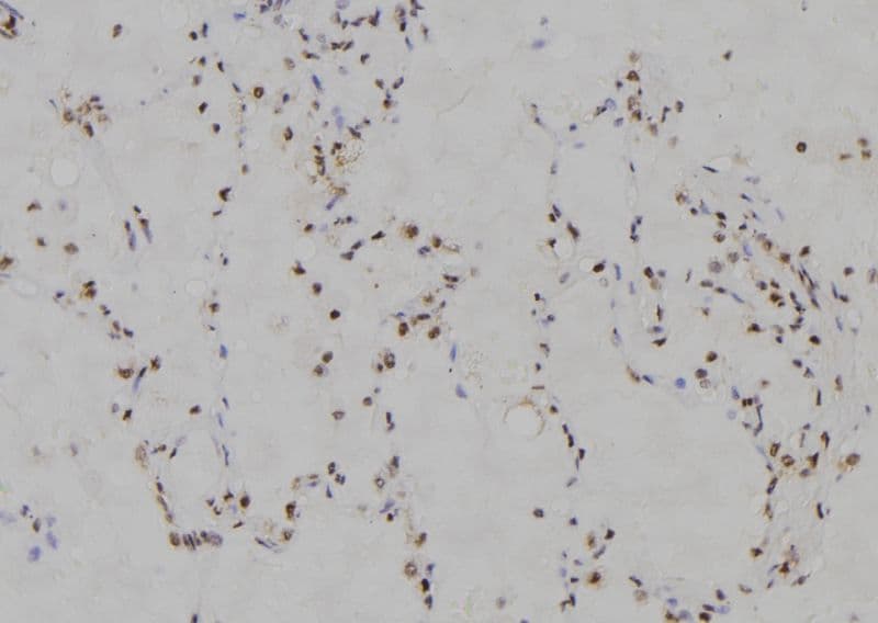 MZF / MZF1 Antibody