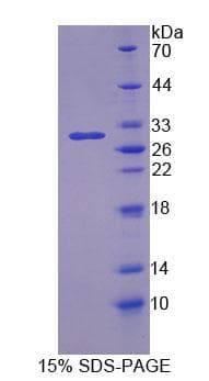Rat OS9 Protein (Recombinant His-T7, N-terminus)