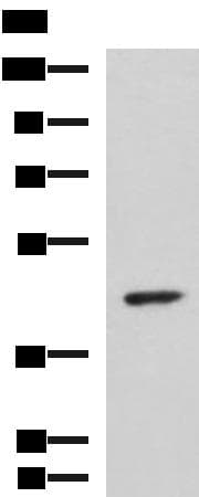 ARPC1B / p41-ARC / ARP2 Antibody