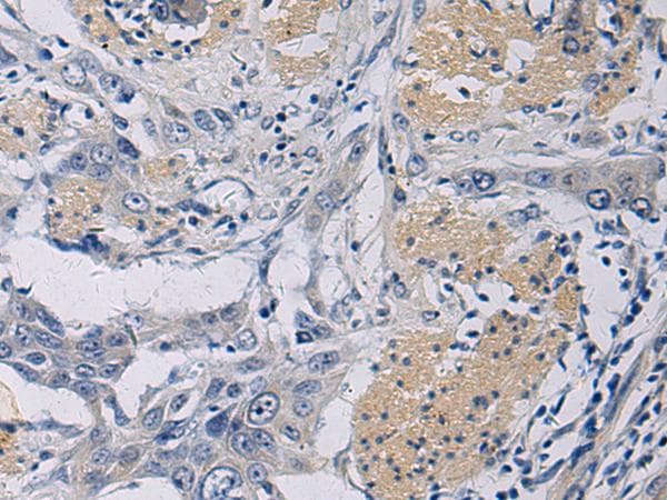 EKLF / KLF1 Antibody