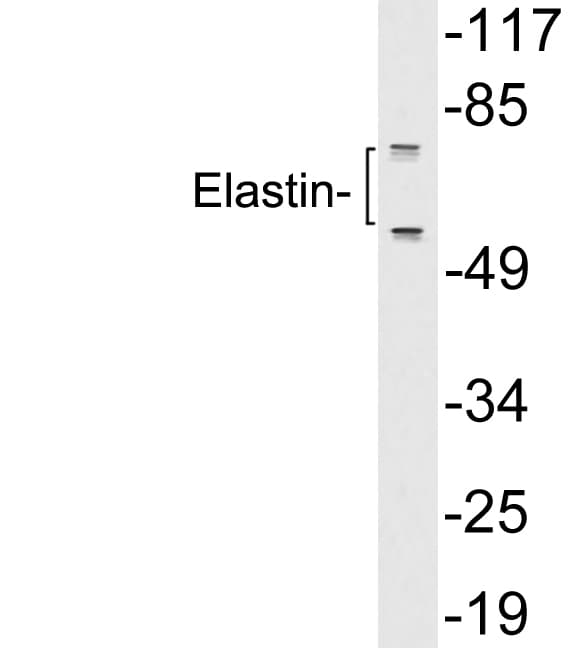 Polyclonal Rabbit anti-Human ELN / Elastin Antibody (aa580-629, WB)
