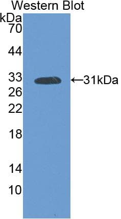 FLT1 / VEGFR1 Antibody (aa303-524)